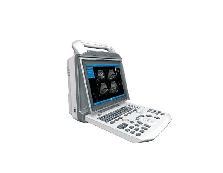 SUCE-I50 12.1'' Digital Ultrasound machine